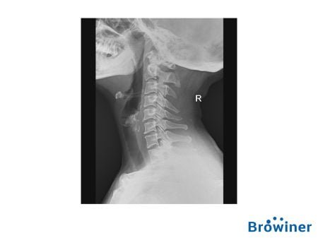 Rayos X portátil Mobile Genius de la marca Browiner, Comercializado en Colombia por B&E Ingeniería Médica,