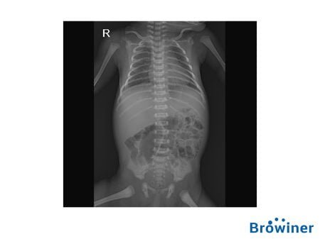 Rayos-X Portatil Emer Neo DR de la marca Browiner. Comercializado en Colombia por B&E Ingeniería Médica.