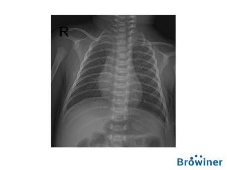 Rayos-X Portatil Emer Neo DR de la marca Browiner. Comercializado en Colombia por B&E Ingeniería Médica.