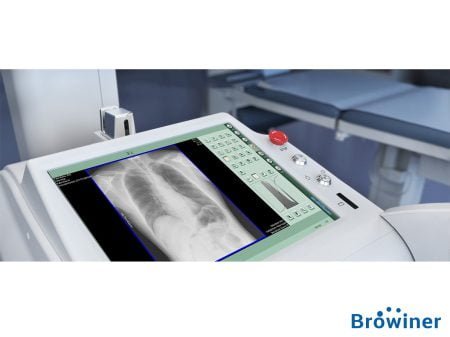 Rayos-X portátil mobile sparkler de la marca Browiner. Comercializado en Colombia por B&E Ingeniería Médica.